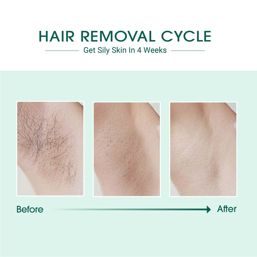 IPL Hair Removal Device with Cooling
